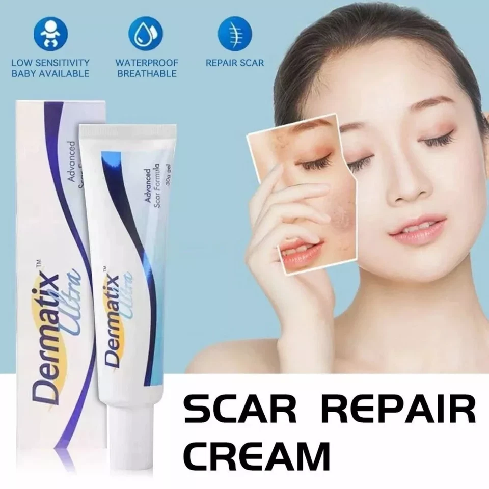 Scar Gel Dermatix Ultra Advanced 15g Silicone Treatment Lot of 10 Tubes - 2027 - Image 2 of 4