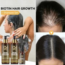 Biotin Hair Growth Shampoo Conditioner Anti Hair Loss Treatment Regrowth Set