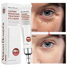 Magic Anti-Aging Eye Cream Reduce Dark Circles Puffiness Under Eye Bags Wrinkle