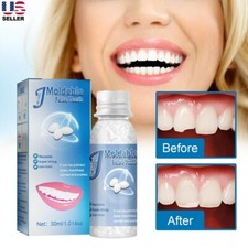 Resin False Teeth Solid Glue Temporary Tooth Gap Filler Tooth Repair Moldable