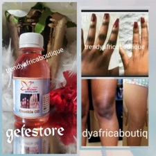 Mino WEDDING secret Knuckle Oil. Peel Off Black Spots 60ml X 1 👌