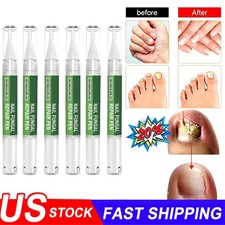 Anti Fungal Treatment Extra Strength Toenail Fungus Foot Nail Repair Pen -20 OFF