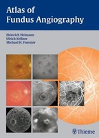 Atlas Of Fundus Angiography | Heinrich Heimann (U. A.) | Buch | 192 S. | 2006