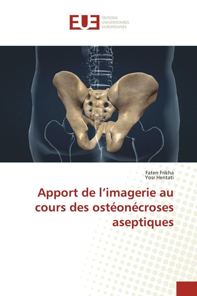 Apport De L'imagerie Au Cours Des OstéOnéCroses Aseptiques Faten Frikha-image