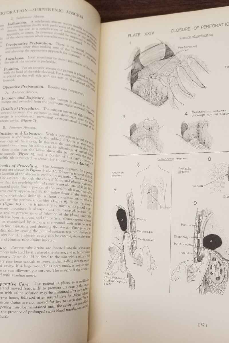 Atlas of Surgical Operations Cutler Zollinger Illustr 1939 (9th pr