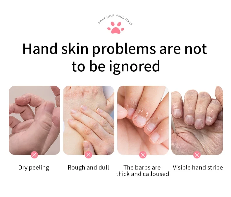 Contour Glove - LED HAND Light Mask Professional Clinic Grade Treatment - Image 4 of 4