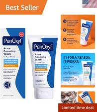 Non-Comedogenic 10 Benzoyl Peroxide Acne Wash - Fast and Effective, 5.5 Oz
