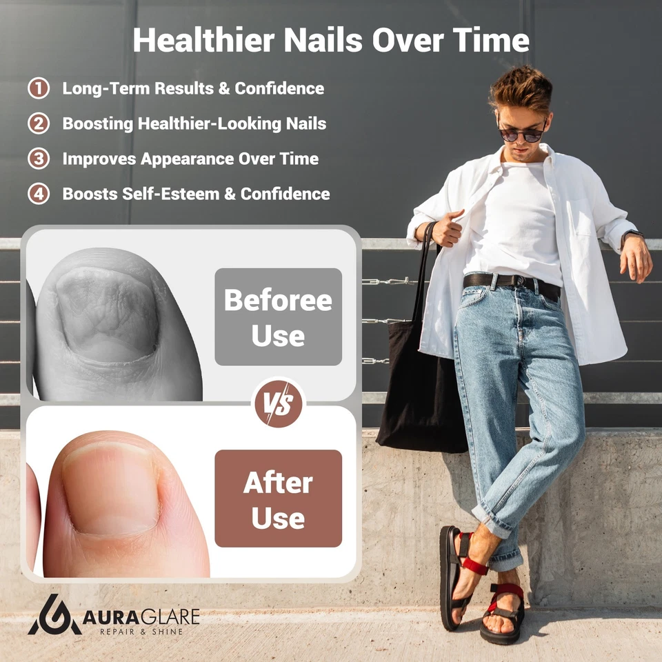 Toe Nail Fungus Light Device- Dual Light with 30 high-efficiency lamp beads - Image 2 of 4