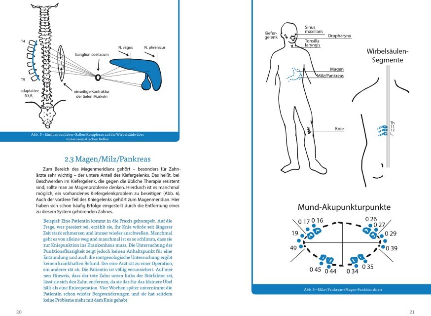 Thumbnail - Wenn Der Kiefer Knirscht Jürgen Schmitter