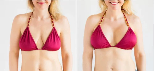 RASSODAMENTO INGRANDIMENTO E AUMENTO DEL SENO INTEGRATORE PILLOLE DONNA FEMME DD - Foto 2 di 7