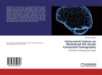 Intracranial Lesions On Multisliced (64 Sliced) Computed Tomography Anju Devi Lo