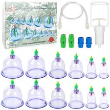 Vacuum Cupping Device Promote Blood Circulation Therapy Device for Body Massage