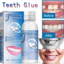 Strong Teeth Tooth Repair Temporary Dental Cement Cavity Filling Kit Fake Tooth