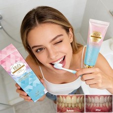 Niacinamide Whitening Toothpaste,Natural Niacinamide Toothpaste,Teeth Whitening