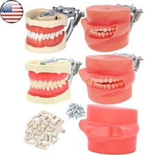 US Dental Typodont Model Kilgore NISSIN 200/500 Type Removable Screw-in Teeth