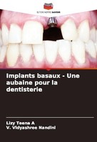 Implants Basaux - Une Aubaine Pour La Dentisterie Lizy Teena A