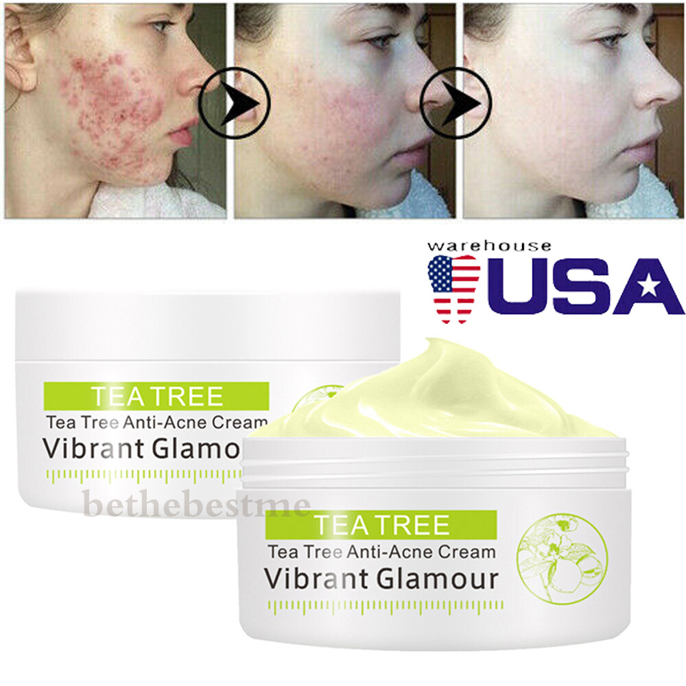 tea tree anti acne cream