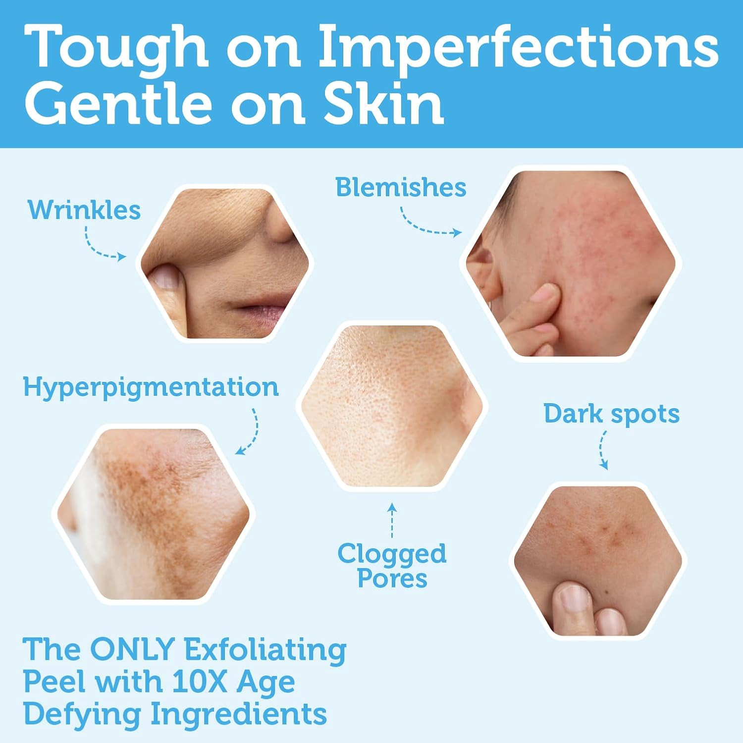 Glycolic Acid Peel AHA BHA Exfoliant - 70% USP Grade Clinical Strength Age-Defyi