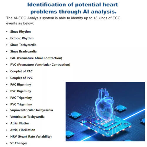 AI EKG ECG Monitor Bluetooth 30s/60s/5min Recording with free App & PC Software - Picture 8 of 15
