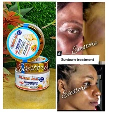 Clear All Sun Burn Day & Night Face Cream. 50g X 1 NOT FOR SENSITIVE skin. 