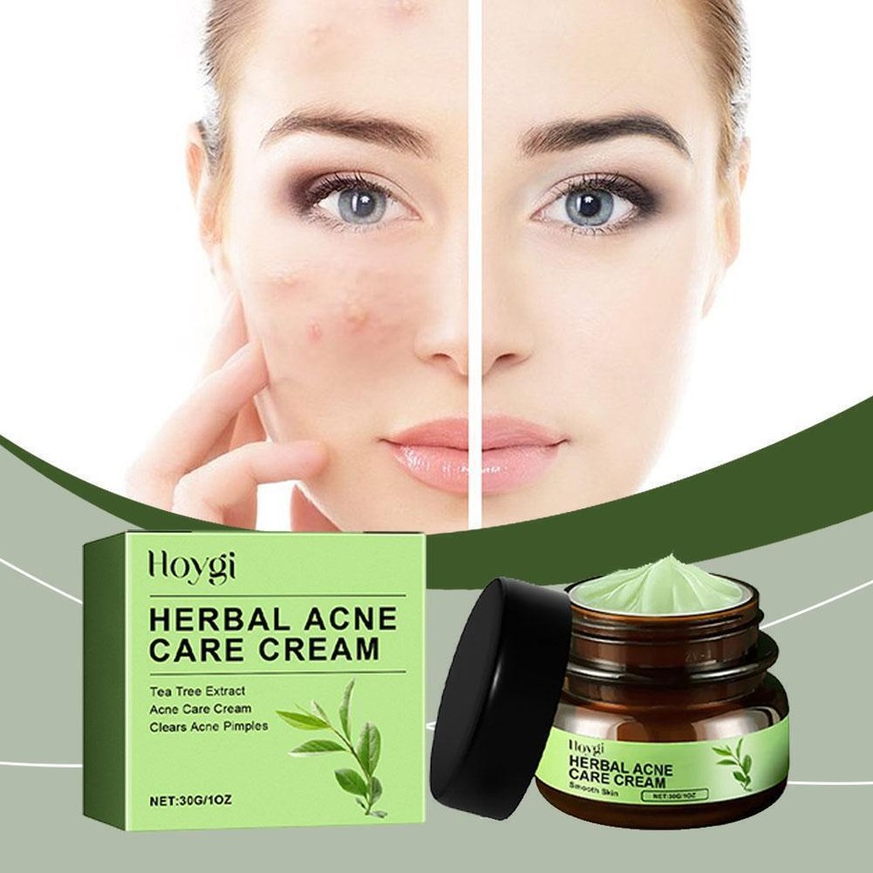 Herbal acne cream facial cleansing moisturizing smooth Y5Q6 eBay