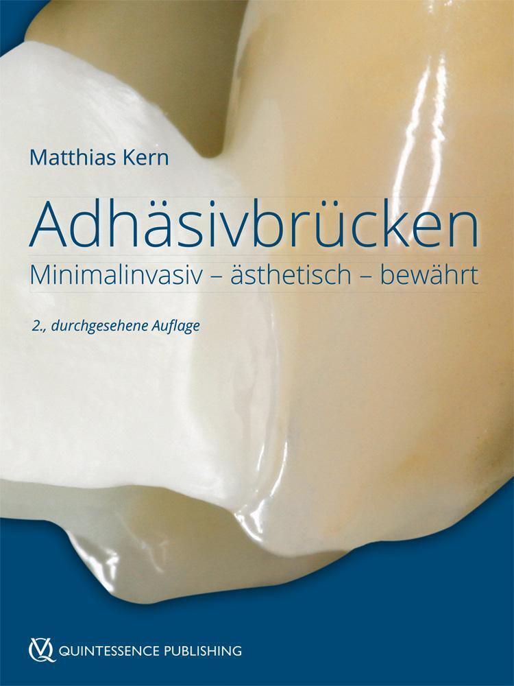 Thumbnail - Adhäsivbrücken | Minimalinvasiv - Ästhetisch - Bewährt | Matthias Kern