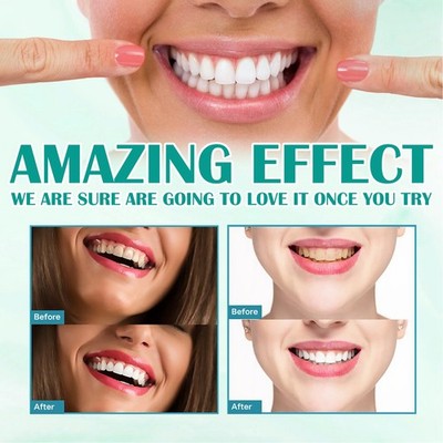 Foam Toothpaste For Deep Cleaning Gums And Whitening Teeth Recommended