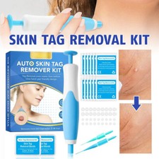 Painless Auto Skin Tag Remover Device Kit Safe Removal 2-8mm Band Tool Home Use
