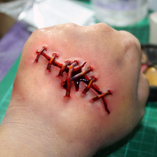 Item image in Latex wounds & scars