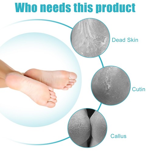 2Pk 4 In 1 Foot Scrubber Dead Skin Remover Foot Files Heel Scraper Pumice Stone - Picture 2 of 7