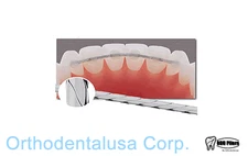 SET x 3 / Flat Lingual Retainer Wire 3-Strand  010"x028" 60 inch spool SS 