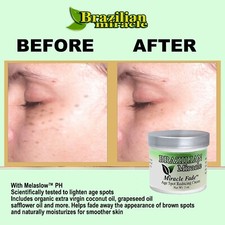 Freckle Fade Cream All Botanical Made In The USA all natural  FREE SHIPPING 