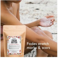Cocoa Butter for Scars  Stretch Marks