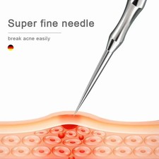 New German Acne Blackhead Removal Needles Pimples Blackhead Clip Tweezers Beauty
