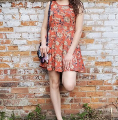 open lace back dress Serano Mini Dress – 310 Rosemont main image 1