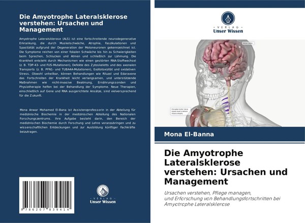 Die Amyotrophe Lateralsklerose Verstehen: Ursachen Und Management Mona El-Banna-image