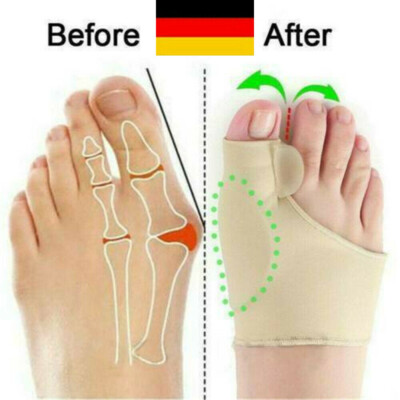 2X Zehenspreizer Hallux Valgus Korrektur - Bunion-Socke - Silikon Gel - Bandage