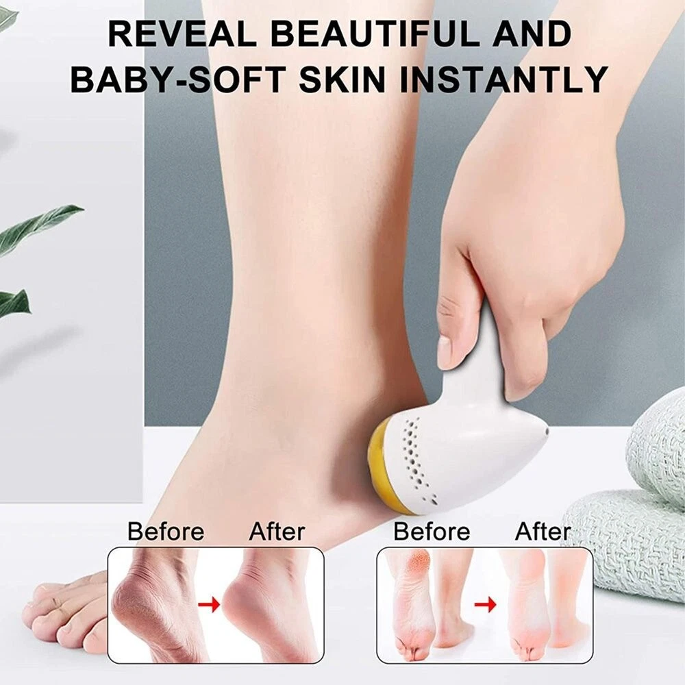 Feet Polisher Clean Hard Dead Skin Foot Grinder Feet File Pedicure
