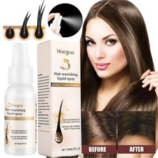 Hair Growth Spray Ginger Anti Hair Loss Fast Regrowth Scalp Treatment Serum 30ml