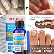 ANTI-FUNGAL MAXIMUM STRENGTH TOENAIL FUNGUS ATHLETES FOOT FUNGI NAIL SUPPORT USA