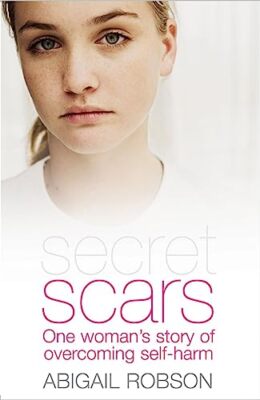 Secret Scars: One Woman's Story of Overcoming Self-Harm Abigail Robson