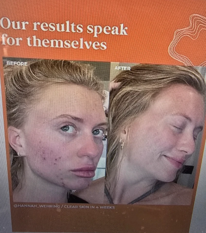 5 Terasana Clear + Control Healthy Skin Serum 1 Fl Oz NEW IN BOX -CBG Squalane - Image 3 of 4