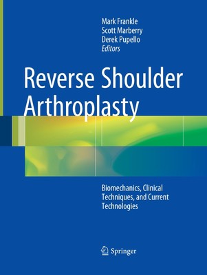 Reverse Shoulder Arthroplasty Mark Frankle