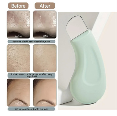 1pc Blackhead and Whitehead Remover Tool Skin Pore Cleaner for Nose and Face