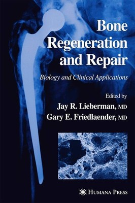 Bone Regeneration and Repair: Biology and Clinical Applications - hardcover ...