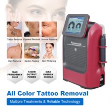 Q Switch ND Yag Pico Tattoo Removal Machine Picosecond for Scar Pigment Whiten