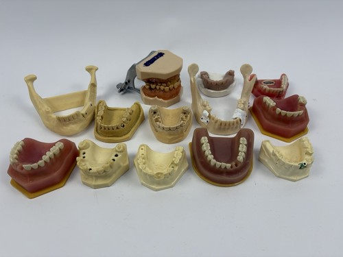 Lot of 13 Dental Oddity Plaster Tooth Teeth Molds Dentist Cast Impressions