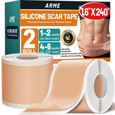 Silicone Scar Tape, 1.6" X 240" Silicone Scar Sheets 2 Rolls-6M , Medical Grade
