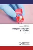 Deepak Vikhe (U. A.) | Immediate Implant Placement | Taschenbuch | Englisch
