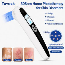 308nm Narrowband UVB Light Therapy Device 6 Diodes 20mWcm2 for Skin Issues Home